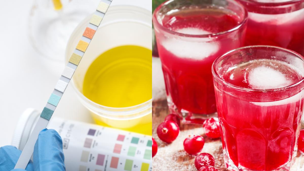 merisoare-infectii-urinare-cistita-acuta_84535300