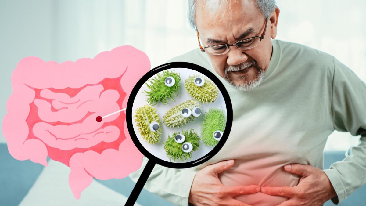 cancer-colorectal_08974300