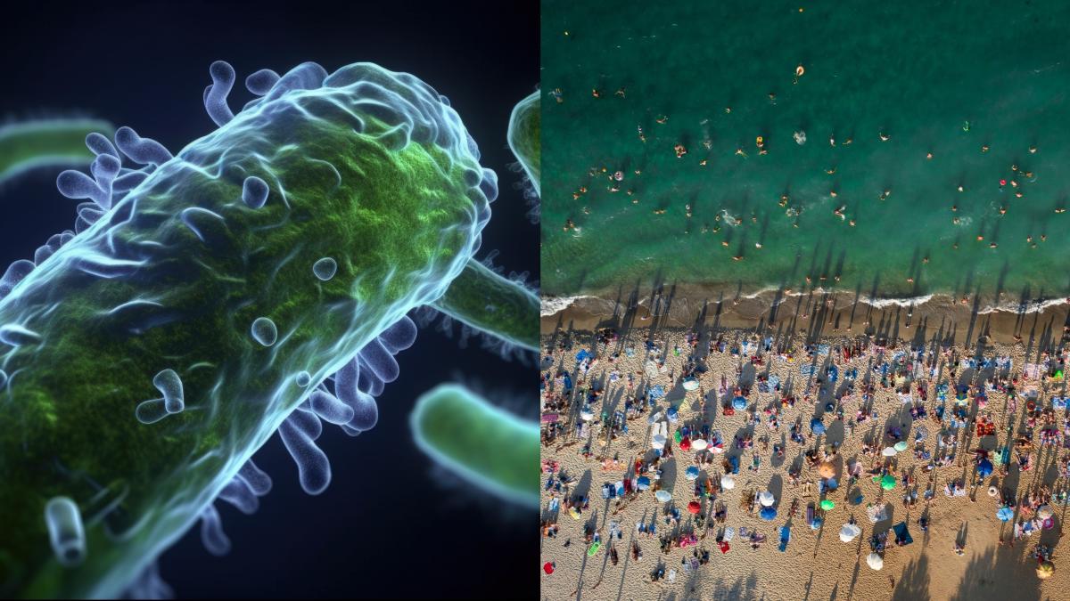 e-coli_45571800