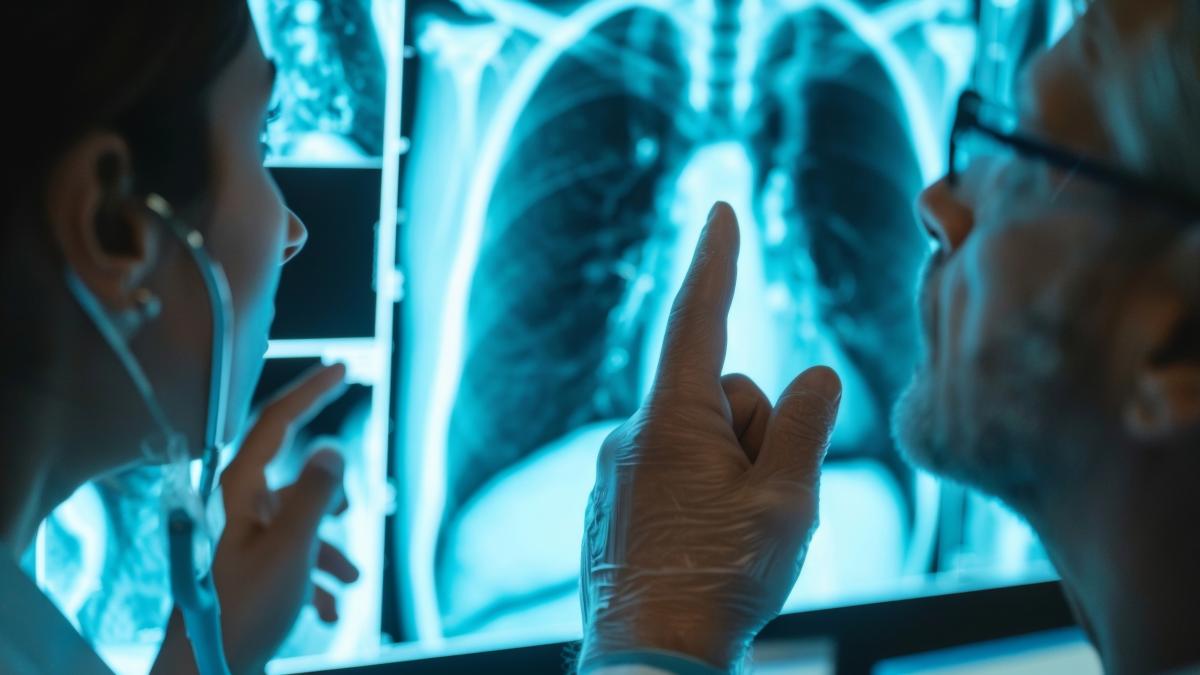 nodulii-pulmonari--diagnostic-_07789400