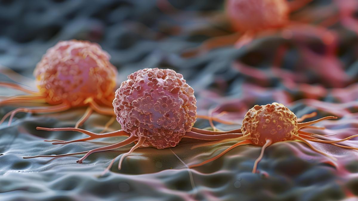 cancer-col-uterin_85820700