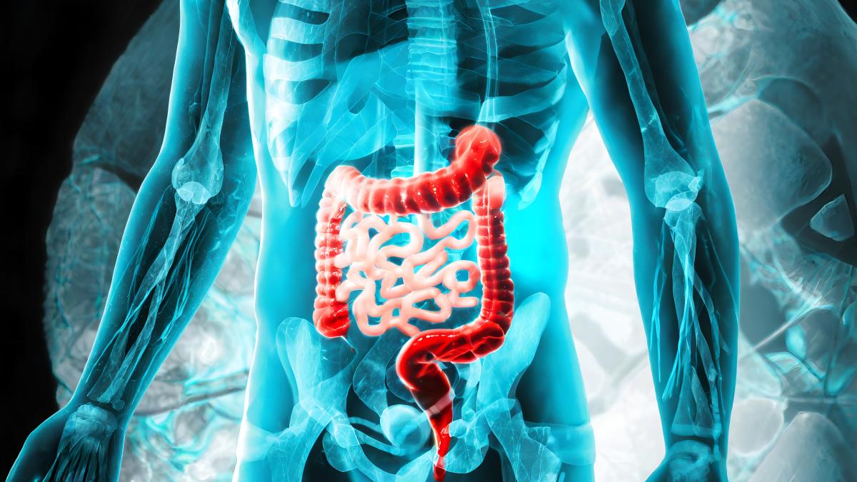 cancer-de-colon1_91453200