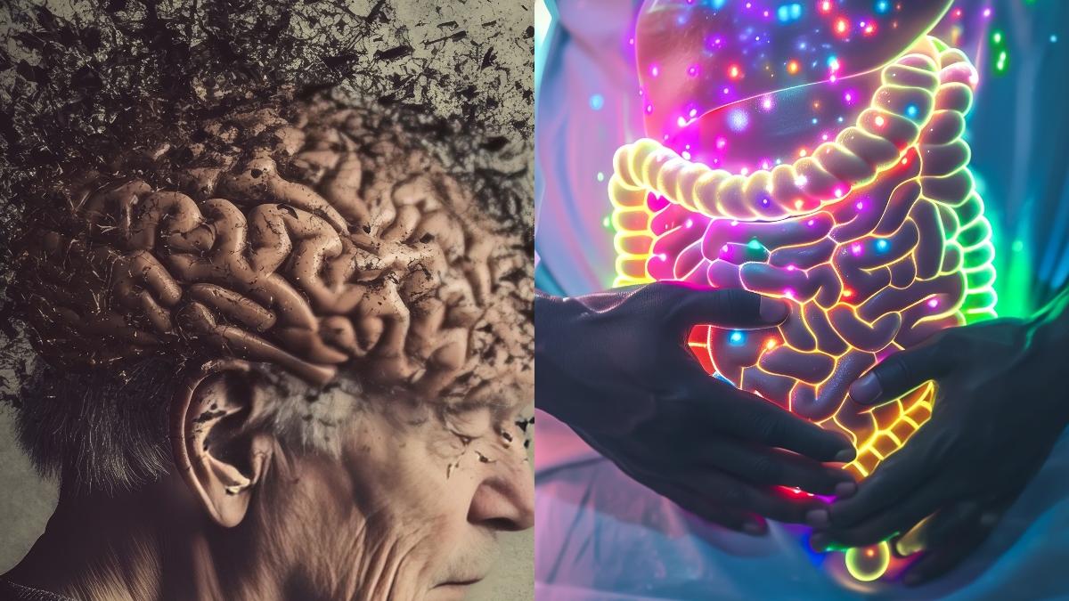 boala-alzheimer-si-cancerul-de-colon--legatura_16082700