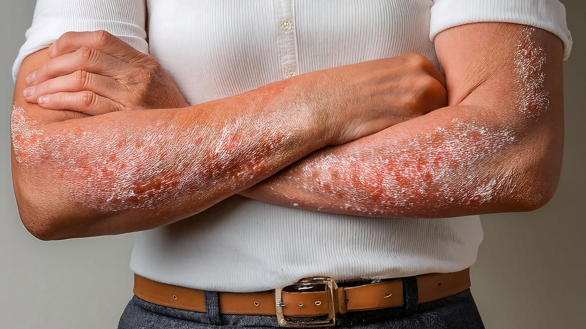 motivele-emotionale-pentru-care-apar-afectiunile-dermatologice-_39610000