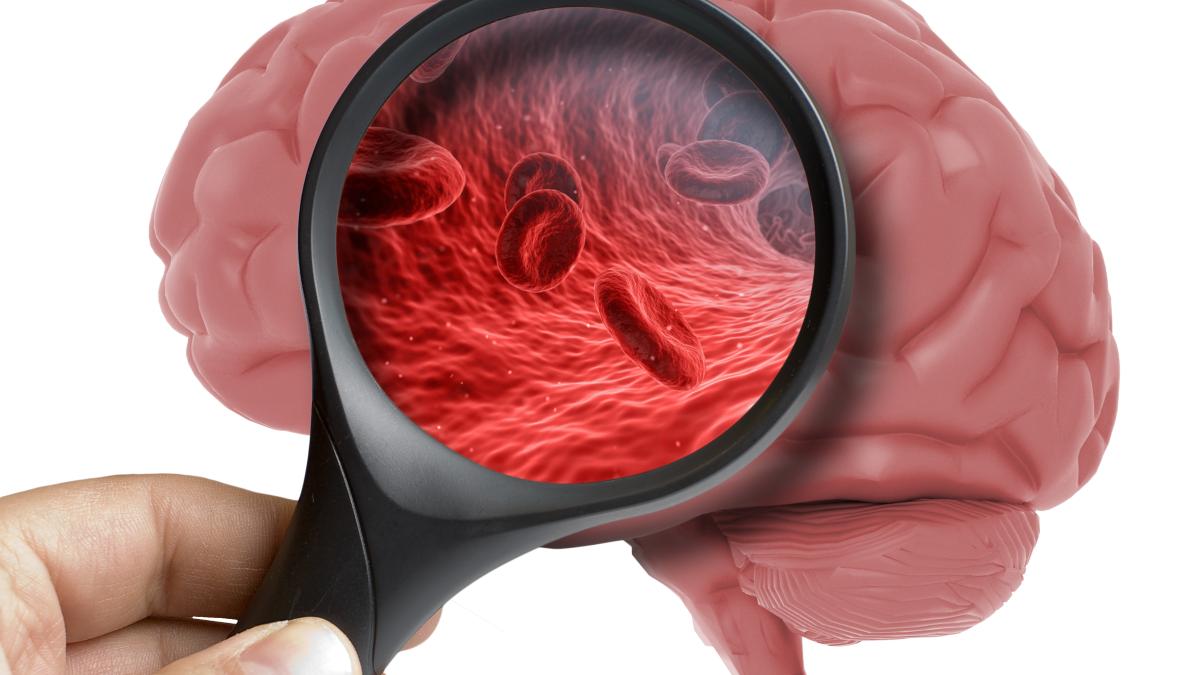 un-oncolog-avertizeaza-ca-durerea-de-cap-care-nu-dispare-dupa-un-analgezic-este-un-simptom-al-cancerului_65301700