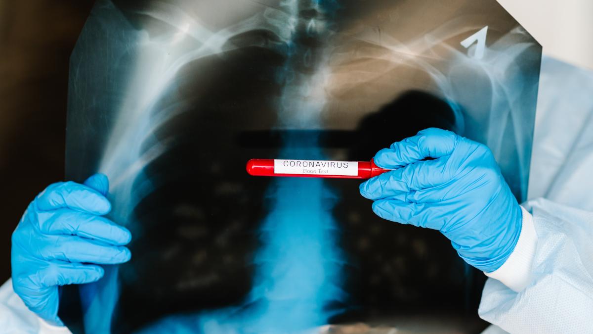test-tuberculoza_39426500