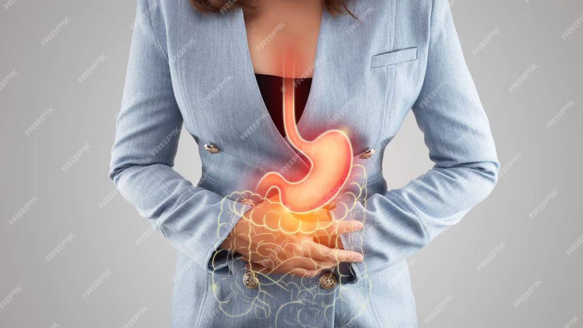 ulcer3_85032200