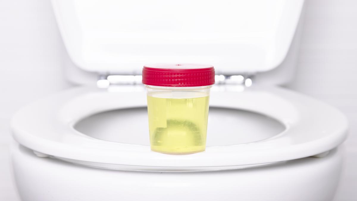 infectii-urinare-iarna_89432200