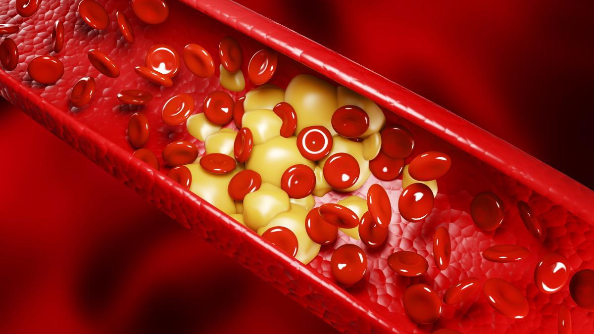 5-alimente-care-iti-reduc-colesterolul-fara-medicamente_32844700