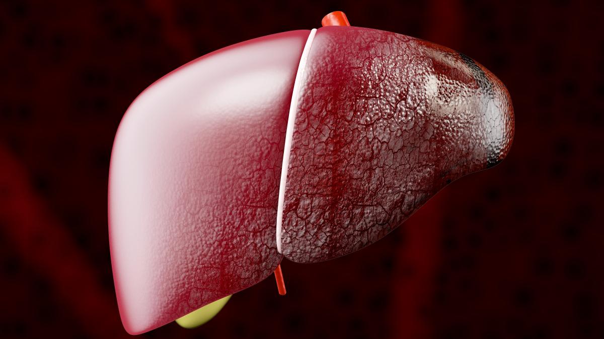 dieta--asociata-cu-dezvoltarea-cancerului-hepatic-_27543700
