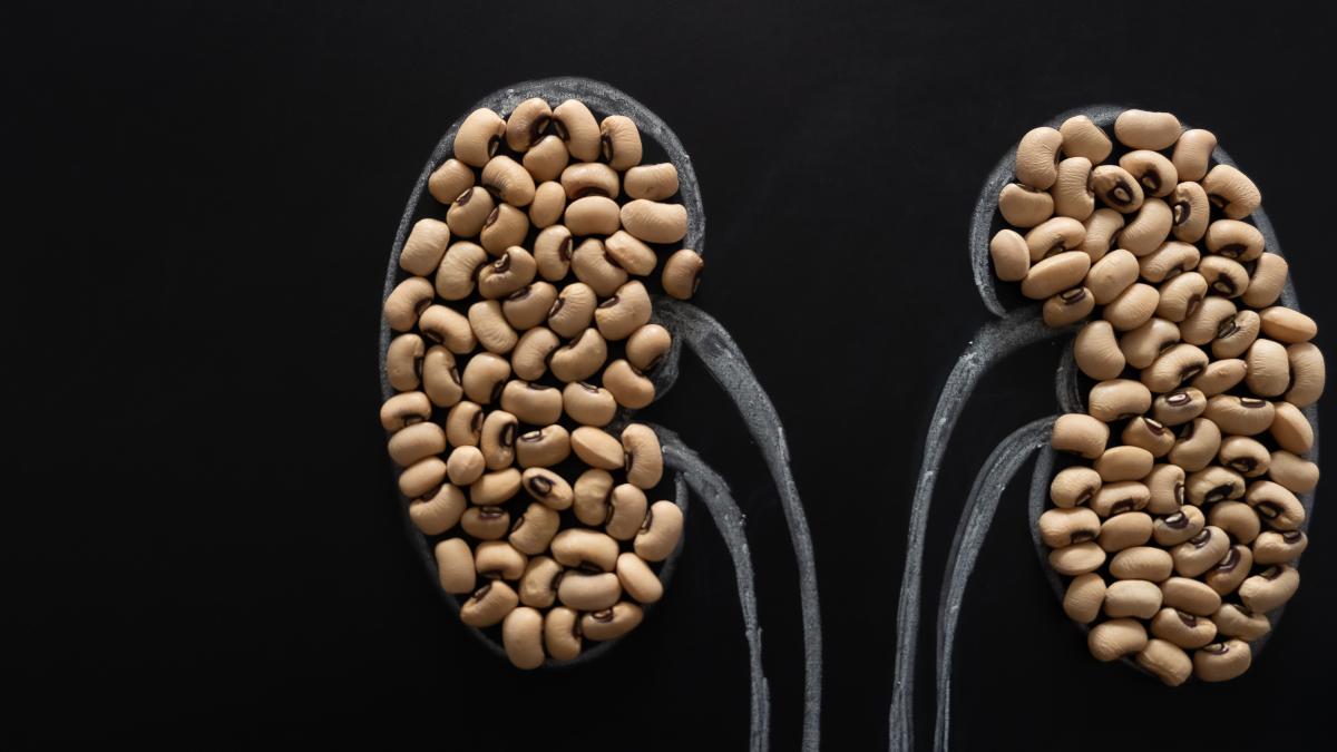 la-ce-dimensiuni-poate-ajunge-un-calcul-renal-_47893100