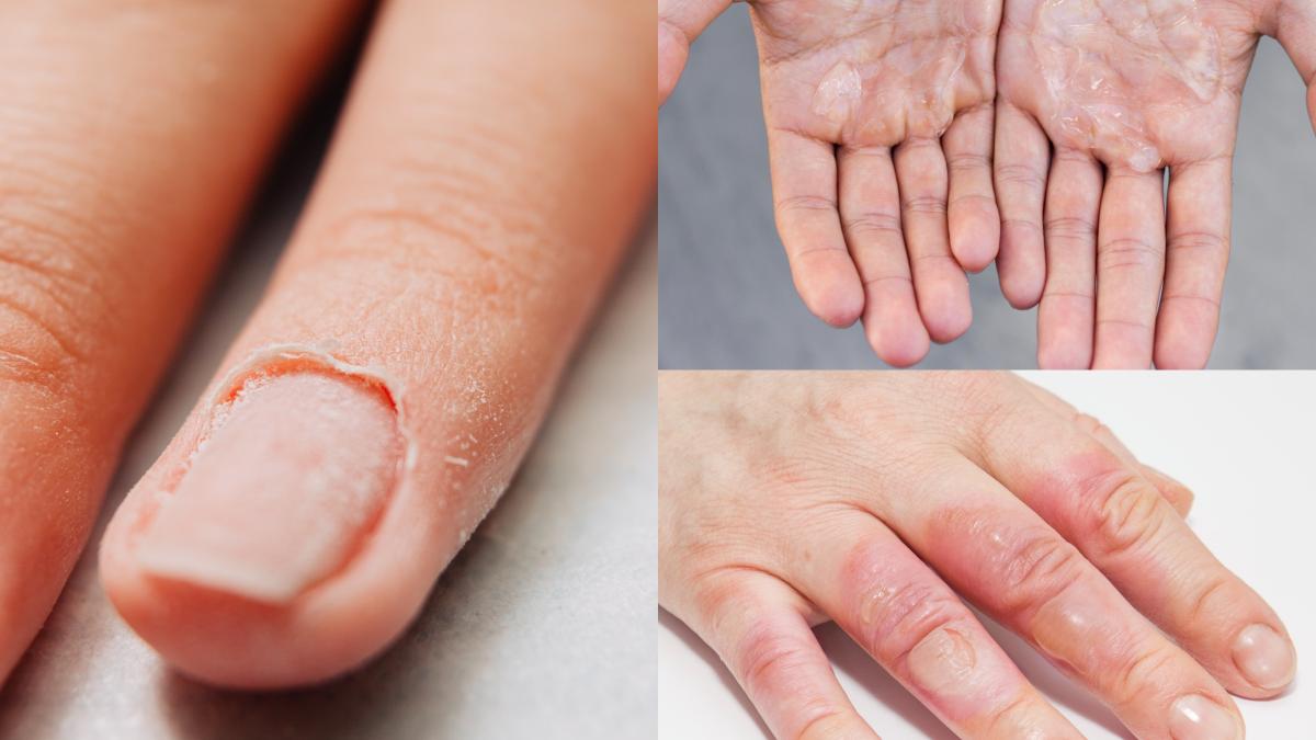 ai-aceste-semne-pe-piele_-sunt-semnul-ca-ai-o-forma-agresiva-de-cancer_44473600