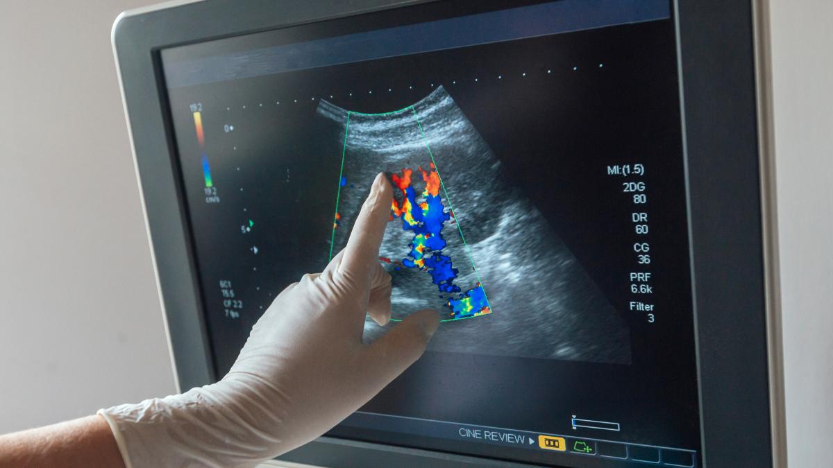 diagnosticul-pe-care-multi-il-primesc-la-un-simplu-ecograf-abdominal--dr--adrian-dijmarescu-descopera-asta-la-o-examinare-de-ficat--colecist--pancreas_04812300