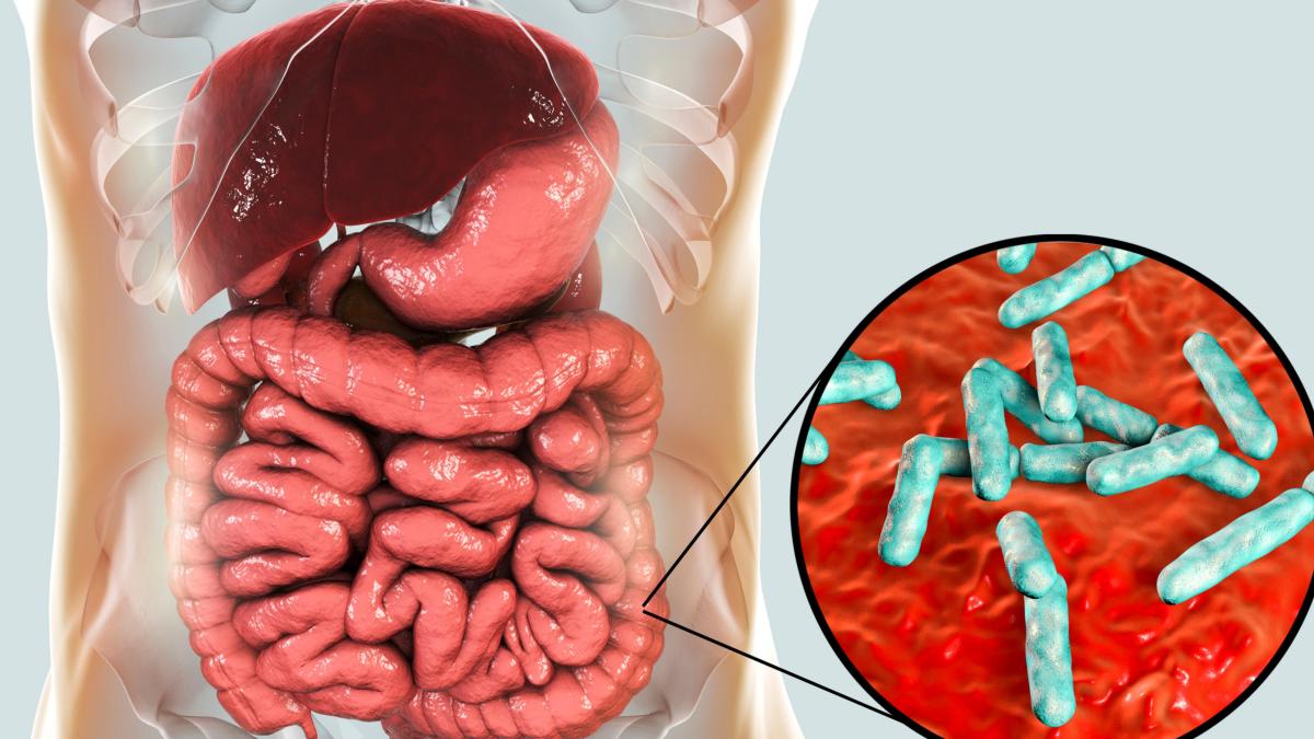 bacteriile-dezechilibrate-sunt-legate-de-scleroza-multipla---raportul-poate-prezice-severitatea-bolii_82531000