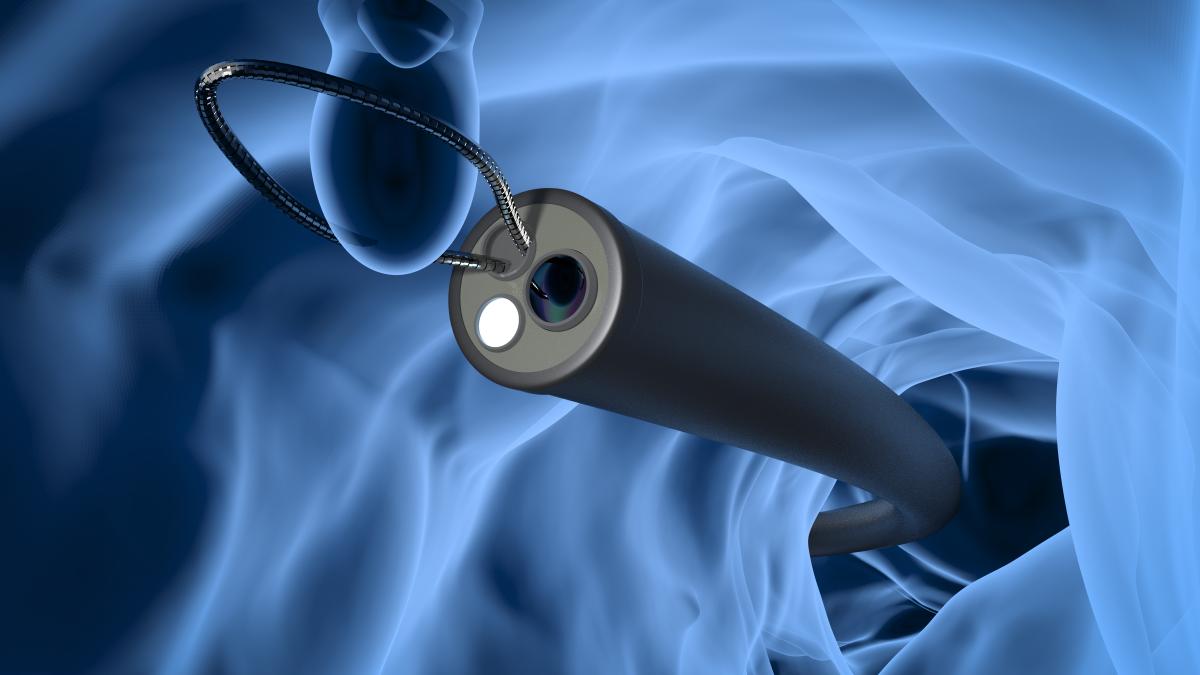 colonoscopie-cancer-colorectal_87348900