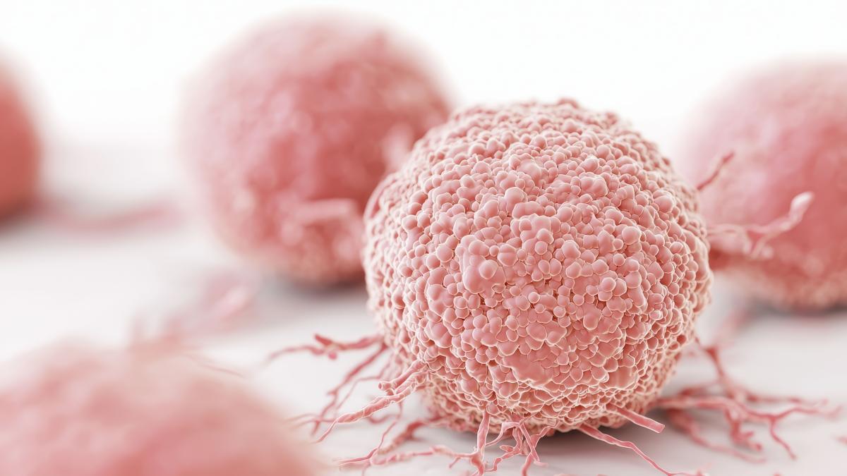 legatura-dintre-grasimi-si-cancerul-de-san-triplu-negativ_96372800