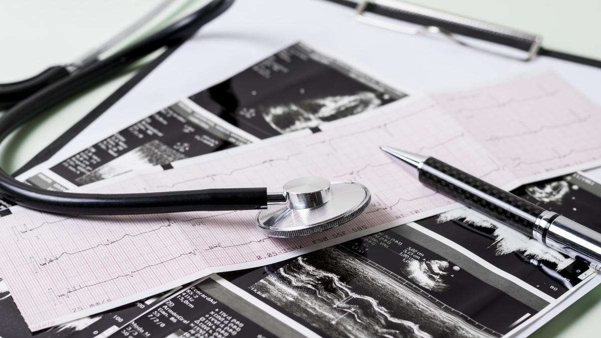 inteligenta-artificiala-poate-prezice-stopul-cardiac-cu-pana-la-doua-saptamani-inainte-de-declansare_77117500