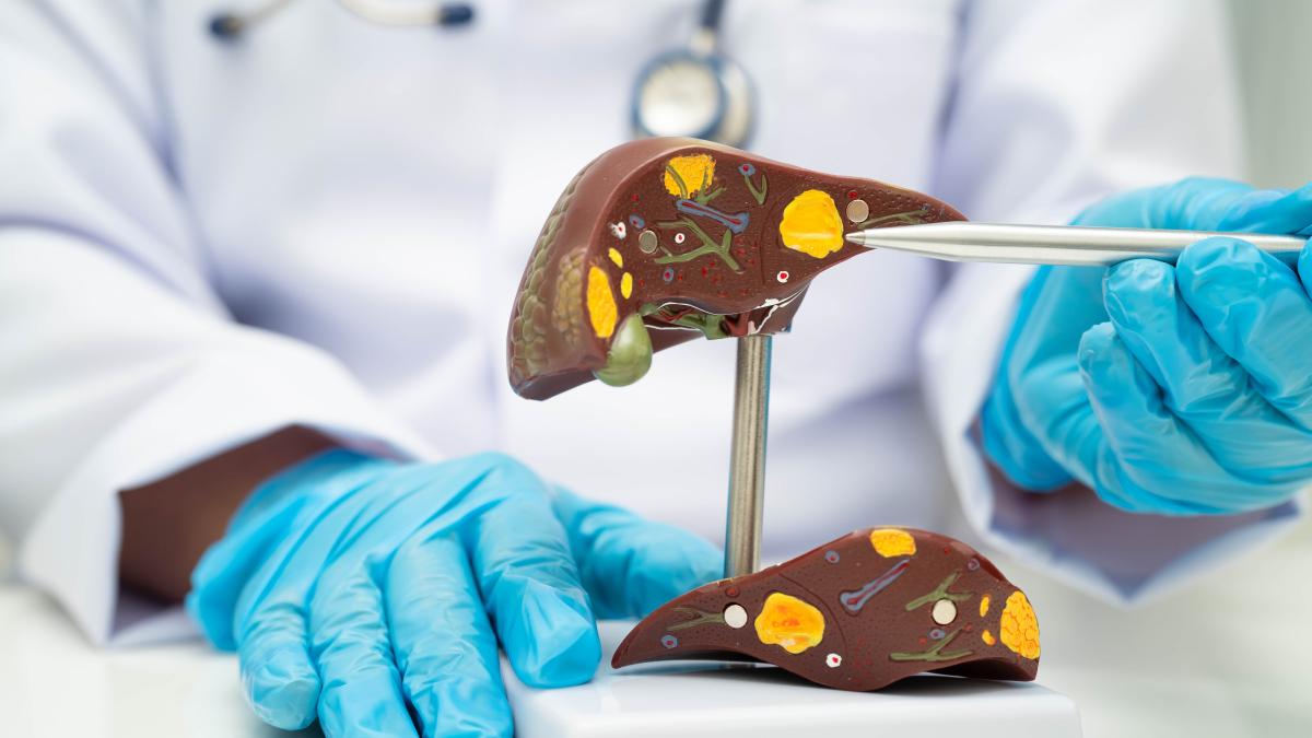 25-de-ani-de-transplant-hepatic-in-romania_66444600