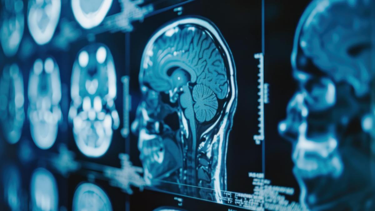 un-nou-indiciu-in-alzheimer--boala-ar-putea-fi-legata-de-vasele-de-sange--nu-doar-de-creier_27719500