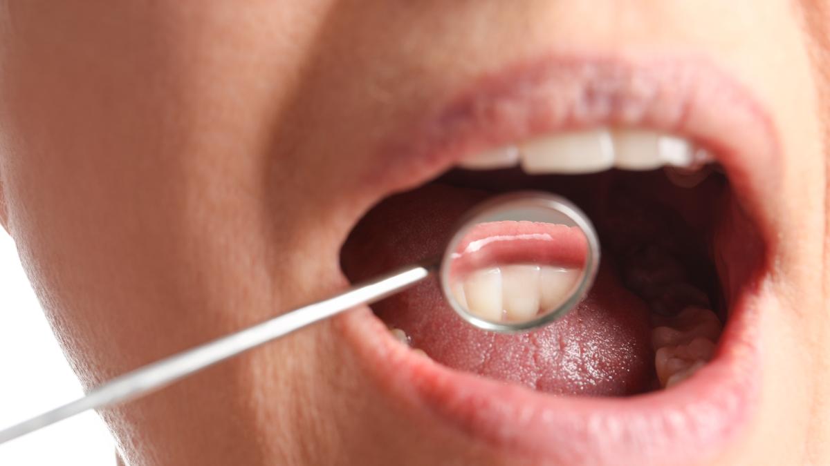 ti-se-retrag-gingiile-un-simplu-gest-zilnic-iti-distruge-dintii-si-gingiile--adevarul-pe-care-nu-ti-l-spune-nimeni_32787900