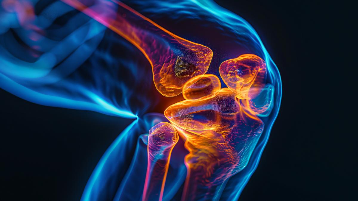 osteoartrita-genunchiului_22712600