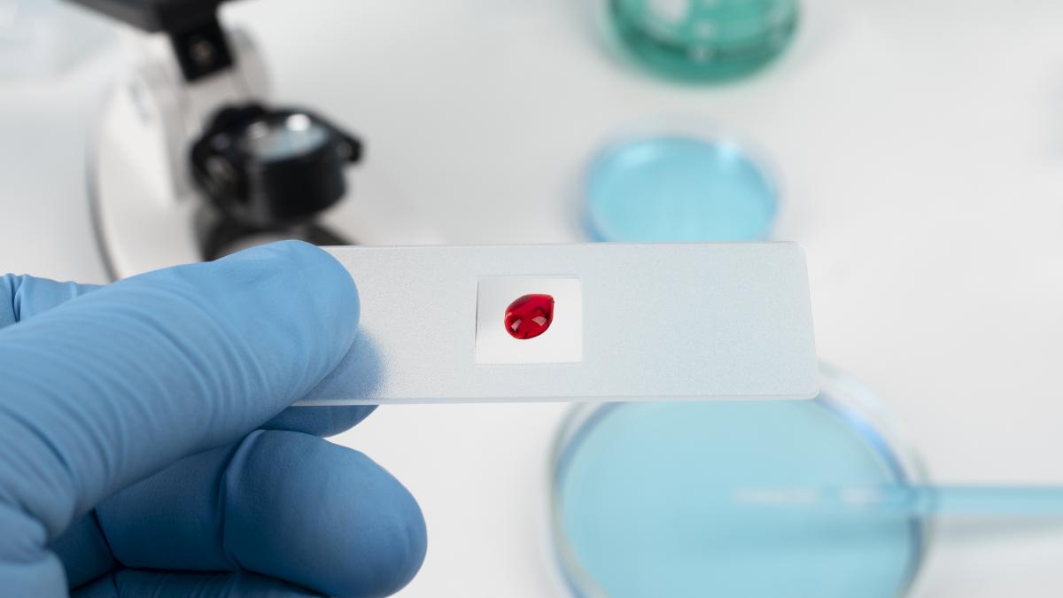 fda-aproba-primul-test-pentru-depistarea-cancerului-de-col-uterin--il-poti-face-acasa_13069700