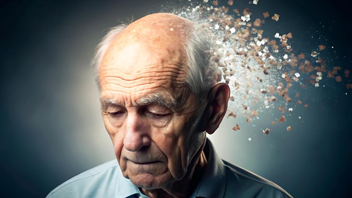 alzheimer_26997700