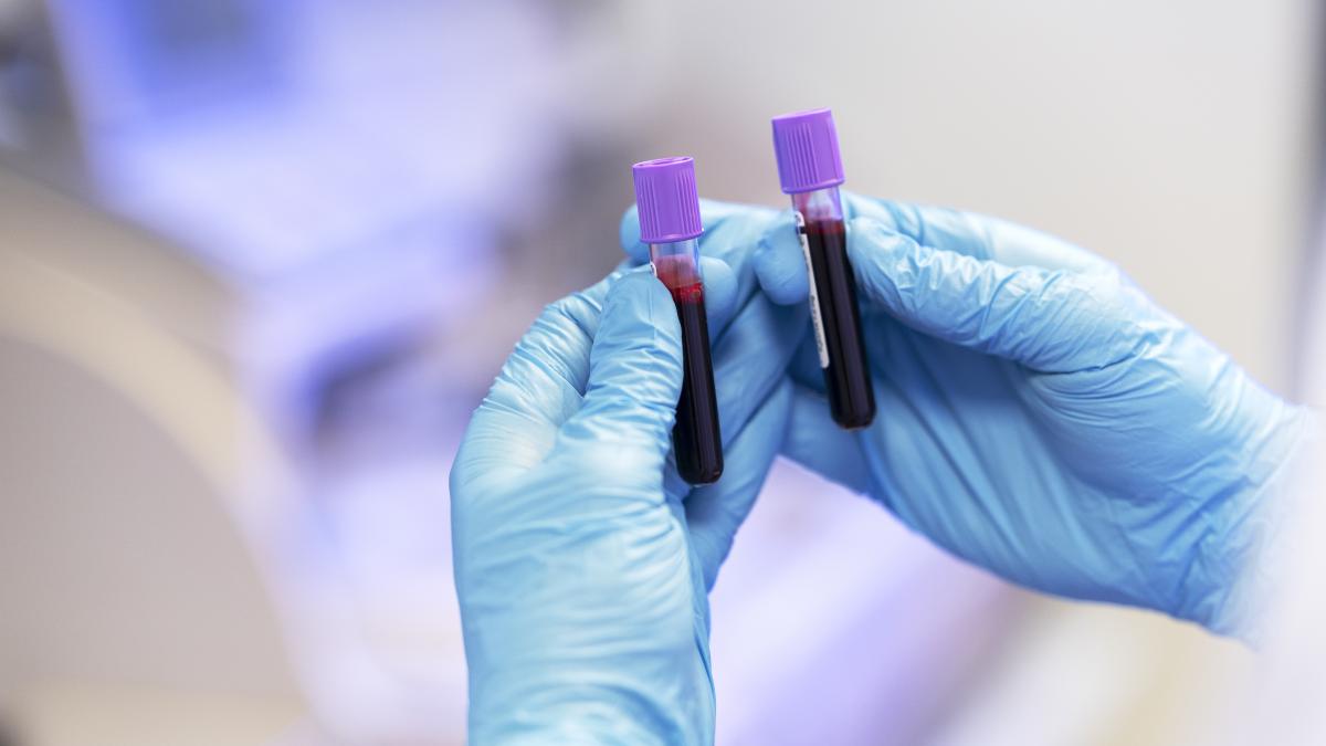 fda-a-aprobat-primul-test-de-sange-pentru-depistarea-bolii-alzheimer_49121300
