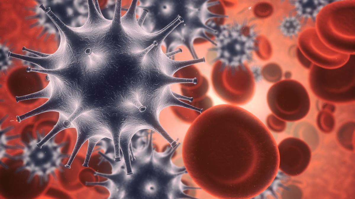sepsis_98646300