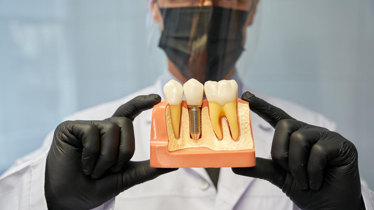 implant-dentar_26639000