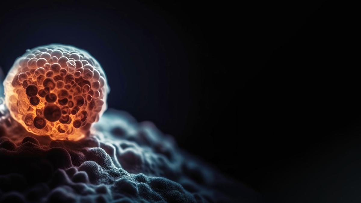 cancerul-pulmonar--progrese-si-provocari-in-tratament--dr--amedeia-nita-avem-acces-la-foarte-multe-medicamente_20799800