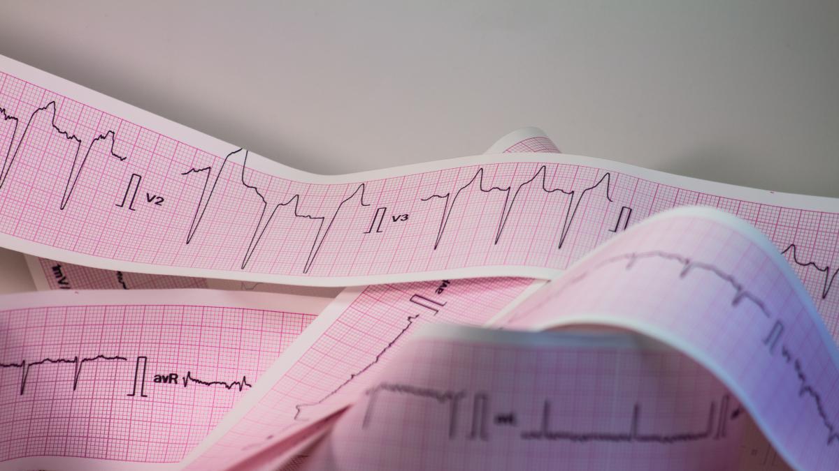 edemul-periferic--simptom-cardiac-ignorat-de-peste-50prc--dintre-pacienti_32552500