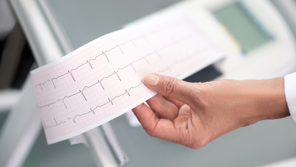 Aritmia severă simptome, cauze și tratament pentru bătăi neregulate ale inimii