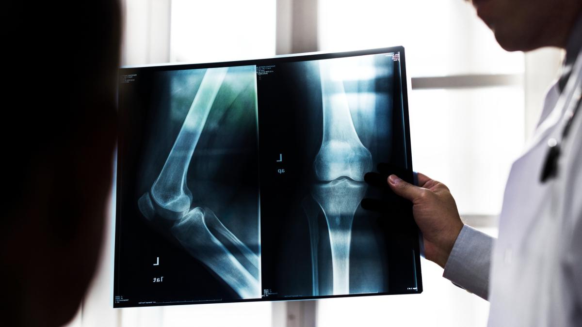 Radiografiile pentru genunchi pot duce la anxietate și operații inutile. Diagnosticul clinic este soluția recomandată pentru osteoartrită.