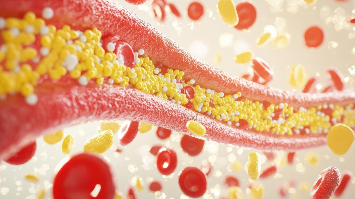 Ghiduri noi pentru colesterol și prevenția bolilor cardiovasculare