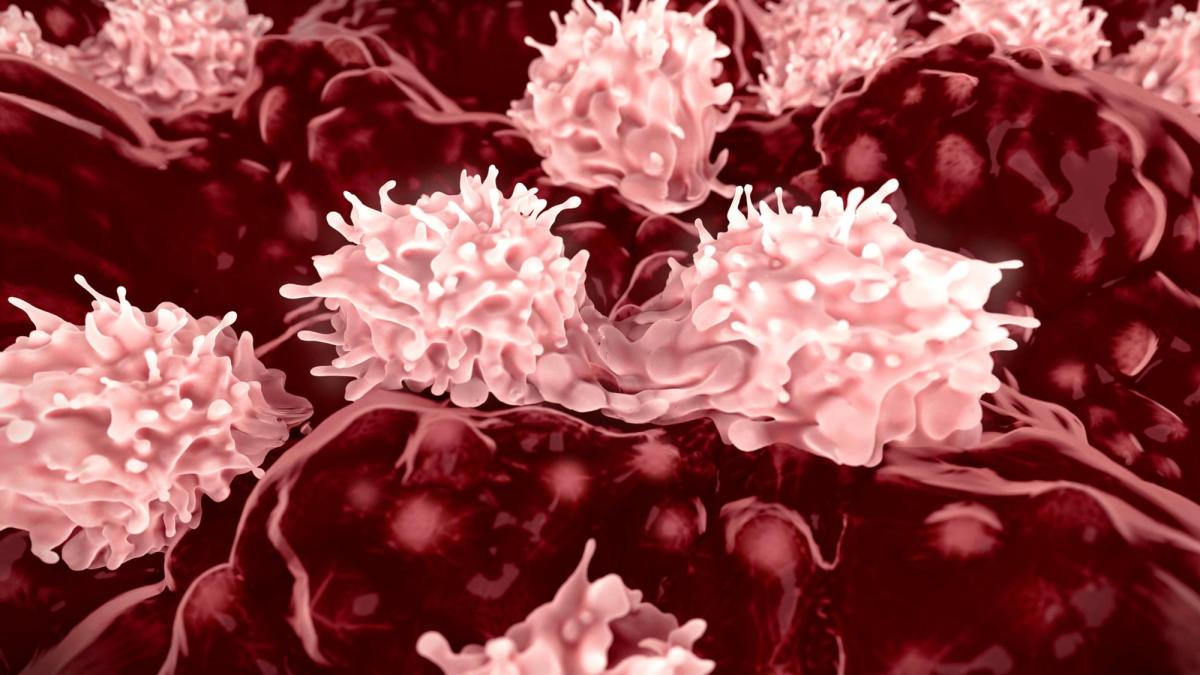 De ce se răspândește cancerul. Cum apar metastazele pulmonare