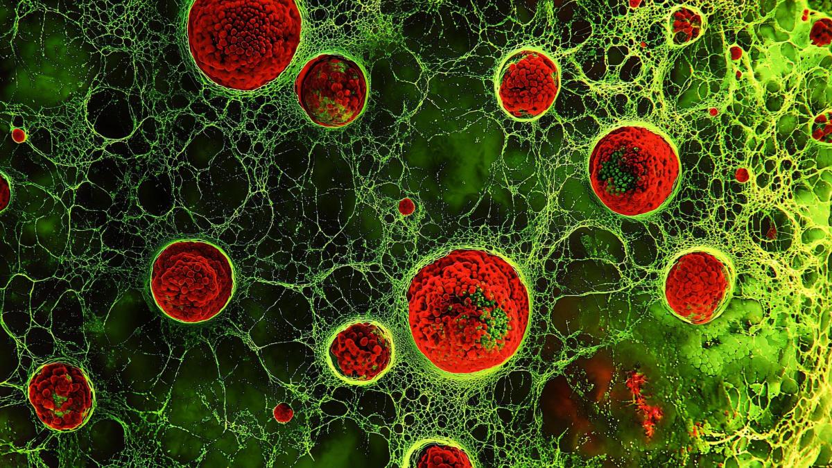 Zeaxantina, nutrientul vegetal care ar putea stimula lupta împotriva cancerului