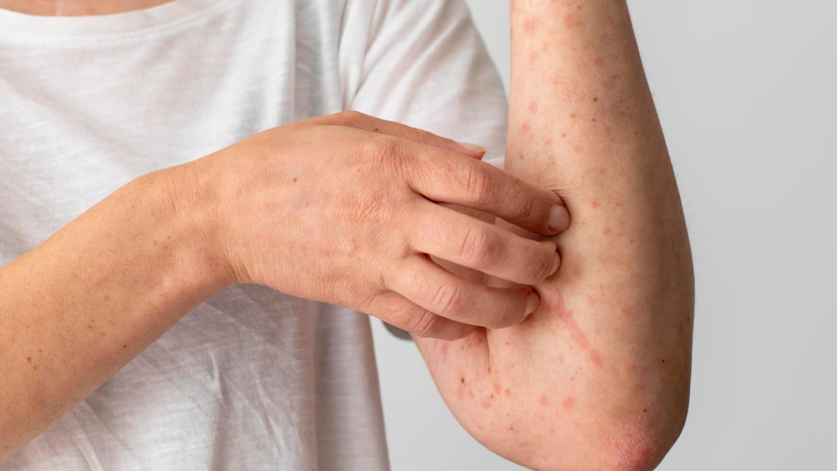 Pneumonia și rujeola ucid copii în România din cauza vaccinării scăzute. Prof. dr. Doina Pleșca Nu este doar o problem a României