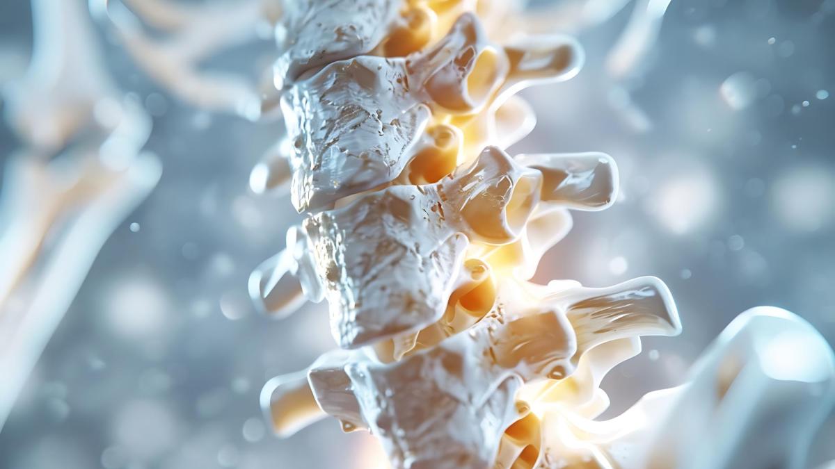 Osteoporoza factori de risc, diagnostic precoce și strategii de prevenție
