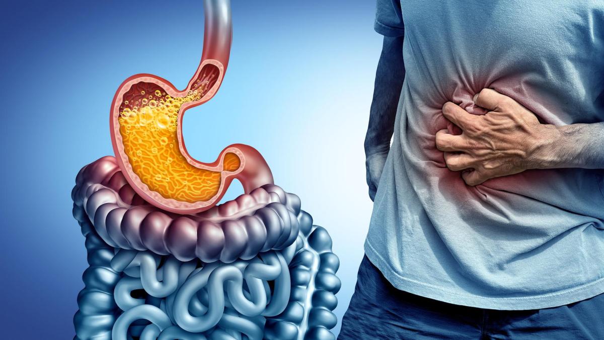 reflux gastroesofagian