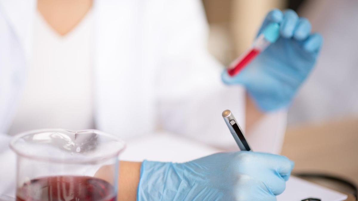 Analiza de sânge care ar putea detecta boala Parkinson înainte de apariția simptomelor