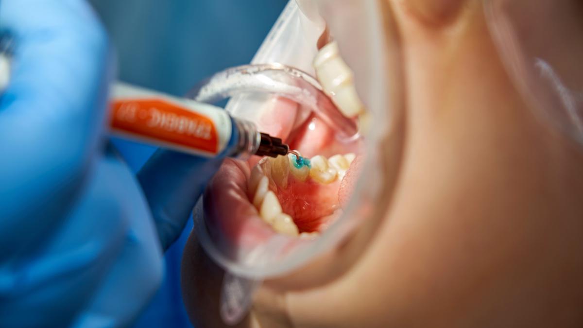 Otrava pe care o avem în corp din cauza dinților. Amalia Năstase Am urme! De acum 40 de ani!