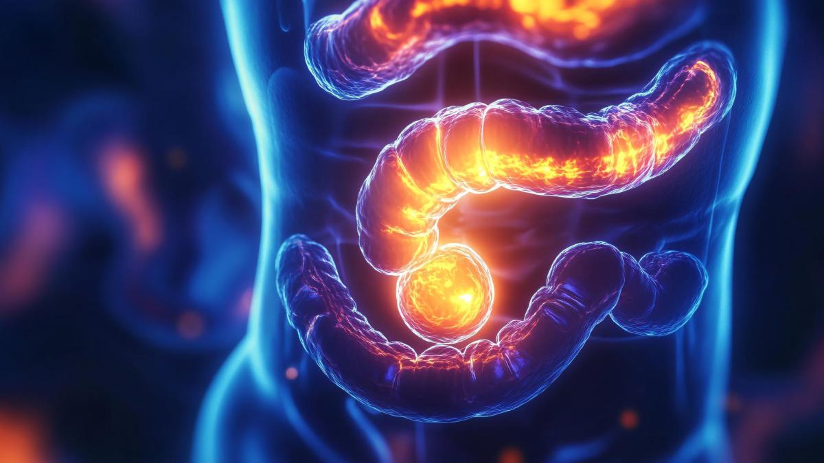 Momentul zero al cancerului de colon a fost descoperit. După acesta, boala devine aproape imposibil de oprit