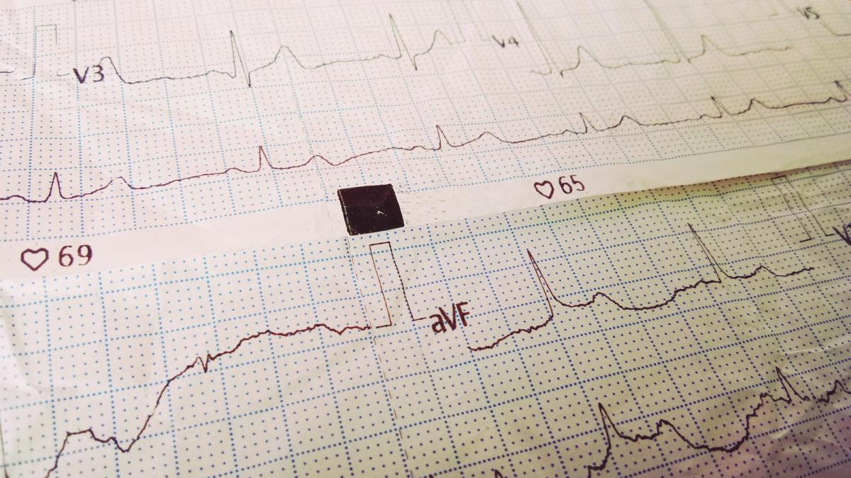 Testul care îți arată din timp dacă inima ta e în pericol înainte de apariția simptomelor