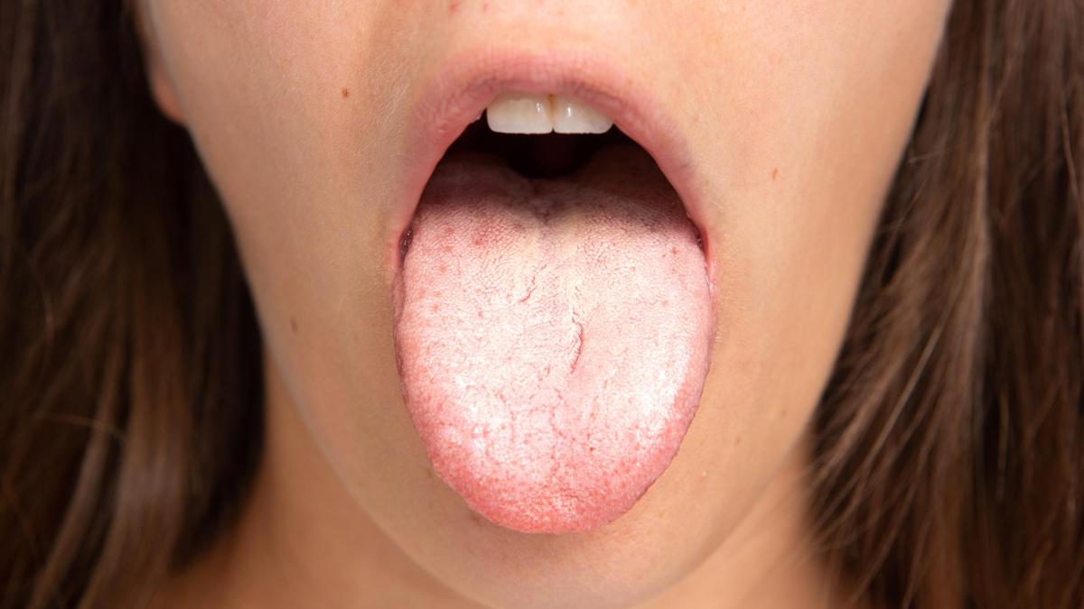 limba-arsa-ars-limba-remedii