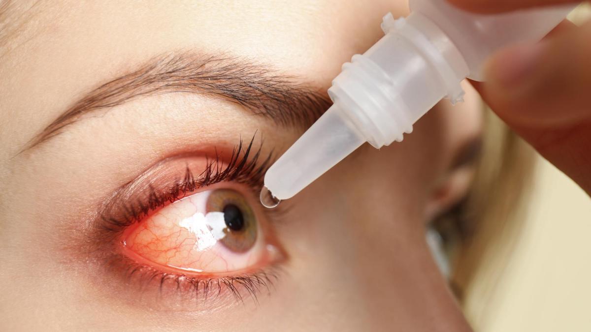 sindromul-de-ochi-uscat