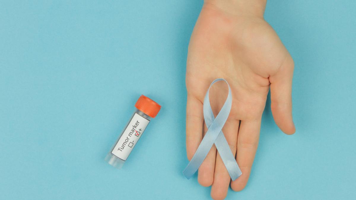 Ce sunt markerii tumorali și ce trebuie să știi despre ei