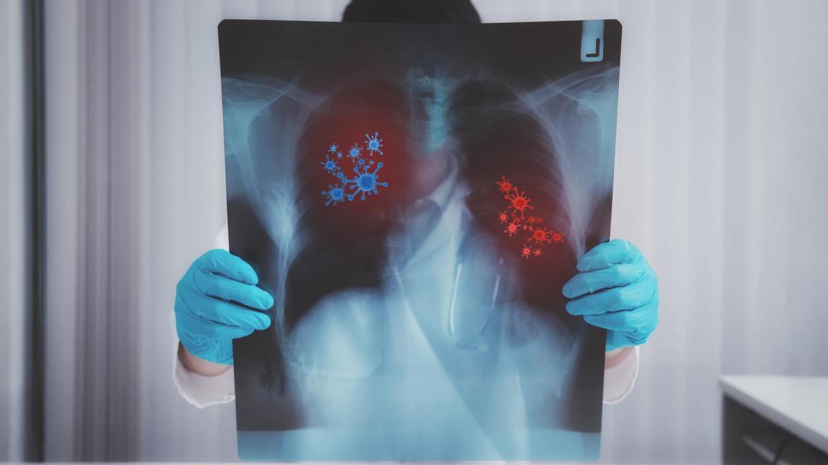 boala-pulmonară-obstructivă-cronică-bpoc-romania-spirometrie-societatea-romana-de-pneumologie