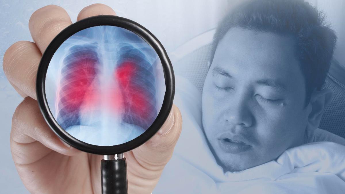 bronsita-acuta-bronsita-cronica-simptome-cauze-contagioasa-tipuri