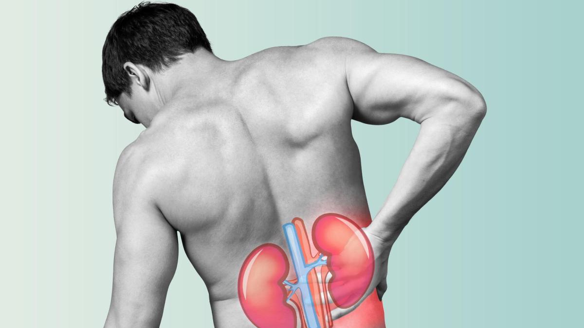 pietre-la-rinichi-litiaza-renala-simptome